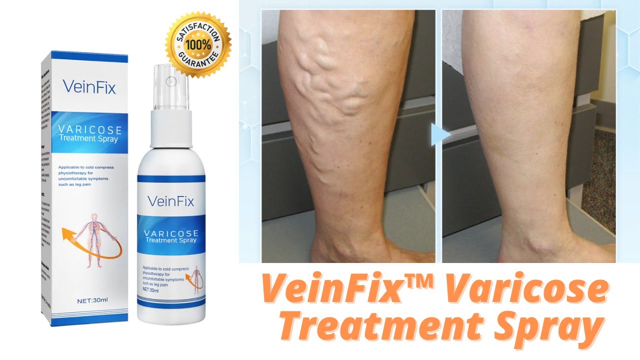 VeinFix Varicose Treatment Spray | Dayiala.com