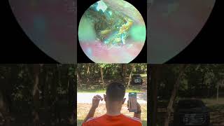 #earwaxremoval #earwax #satisfying #cleaning #removal