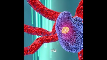 The Future of Cancer Detection: AI Micro-Robot Swarms in Pancreas