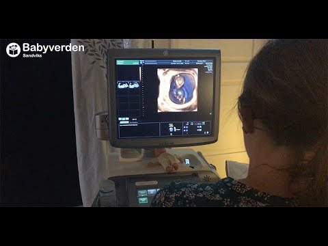 Video: Forskjellen Mellom Sonogram Og Ultralyd