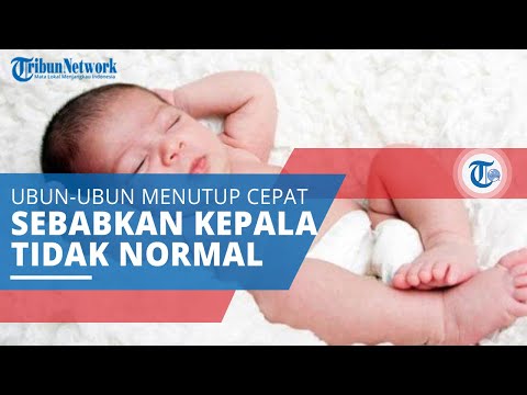Video: Kapan tengkorak bayi yang baru lahir mengeras?