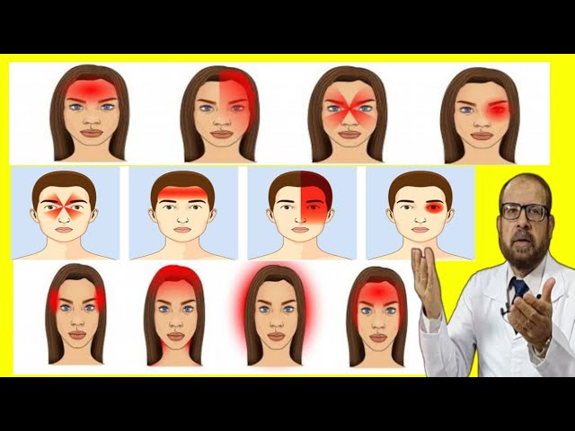 أسرع علاج لألم الصداع المزمن وأسبابه دكتور جودة محمد عوض يوتيوب