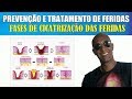 PREVENÇÃO E TRATAMENTO DE FERIDAS – CICATRIZAÇÃO POR PRIMEIRA E SEGUNDA INTENÇÃO