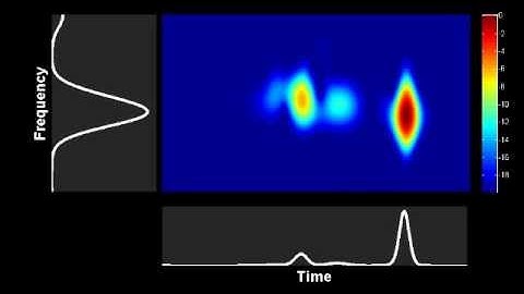 Spectrogram : propagation of a higher order soliton in presence of third order dispersion