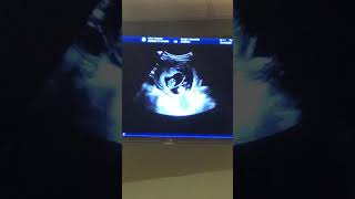 TRIPLETS?!? Mom’s first ultrasound is a HUGE surprise!