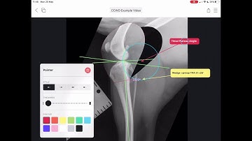 How to plan a CCWO Cranial Closing Wedge Ostectomy  in vPOP Pro!