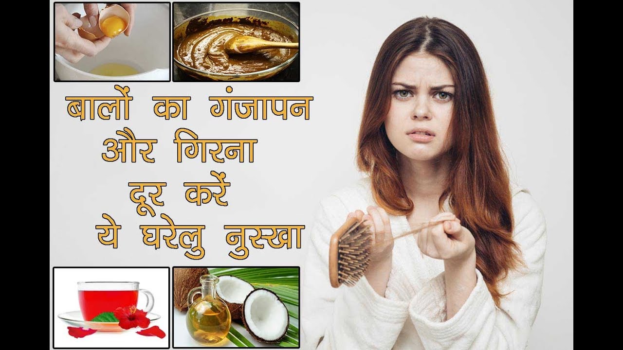झड रहे हैं बाल ,तो करे ये उपाय || Remedies For Hair Loss ||Hair Treatment.
