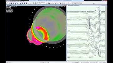 Mill Damage Inspection with Multi Finger Caliper