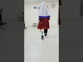 Dysmila patient walking with their new prosthesis 🦾🦿
