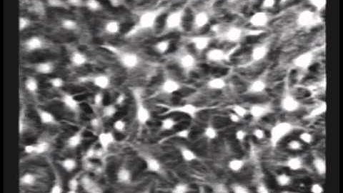 Glutamate-induced Ca wave in high-density astrocyte culture