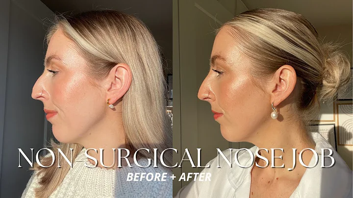 I GOT A NON-SURGICAL NOSE JOB FOR OUR WEDDING DAY|...