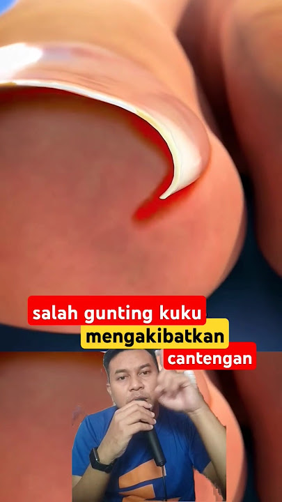 Penyebab cantengan di kaki #nails #nailart #satisfying