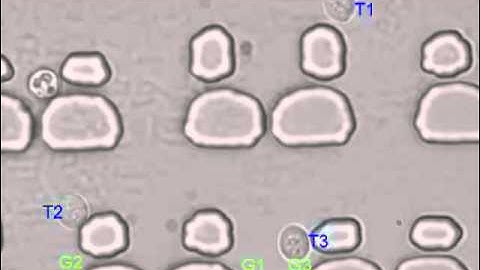 Automatic Manipulation of Cells Inside Microfluidic Chamber Assisted by Optical Tweezers
