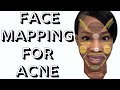 Face Mapping For Acne