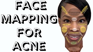 Face Mapping For Acne
