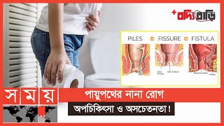 পাইলস, ফিসার ও ফিস্টুলায় আর নয় অবহেলা | বদ্যি বাড়ি | পর্ব-৫৫ | Piles | Fissure | Fistula |Boddi Bari