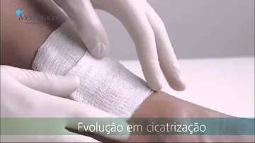 Como usar a membrana regeneradora porosa?