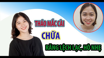 THÁO MẮC CÀI NIỀNG RĂNG - Tạm biệt hàm răng lệch lạc, cắn hở, móm nhẹ