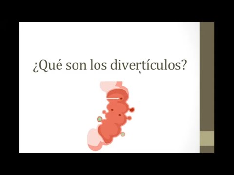 ¿Qué son los