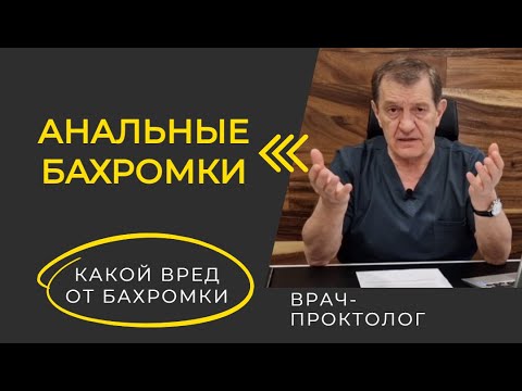 Багдасарян лев карапетович. Канальные бахромки фото. Багдасарян Лев Карапетович проктолог, колопроктолог отзывы.