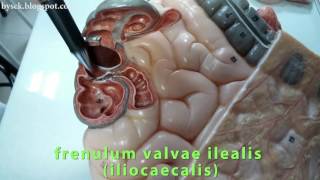 Colon (Kalın Bağırsak) Bölümleri, Caecum