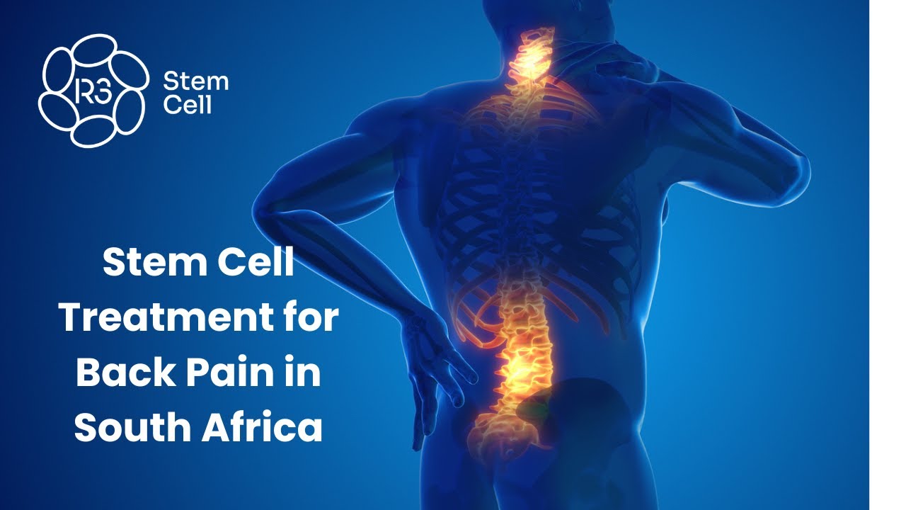 Stem Cell Therapy for Chronic Back Pain in South Africa | Non-Surgical ...