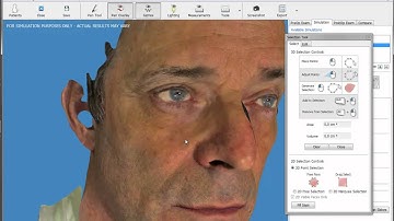 Nose Job (Rhinoplasty)3D Virtual Simulator -freehand nose reshaping tool with AxisThree software