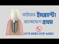 গাইডেড ডেন্টাল ইমপ্ল্যান্ট সার্জারি | বাংলাদেশে এই প্রথম
