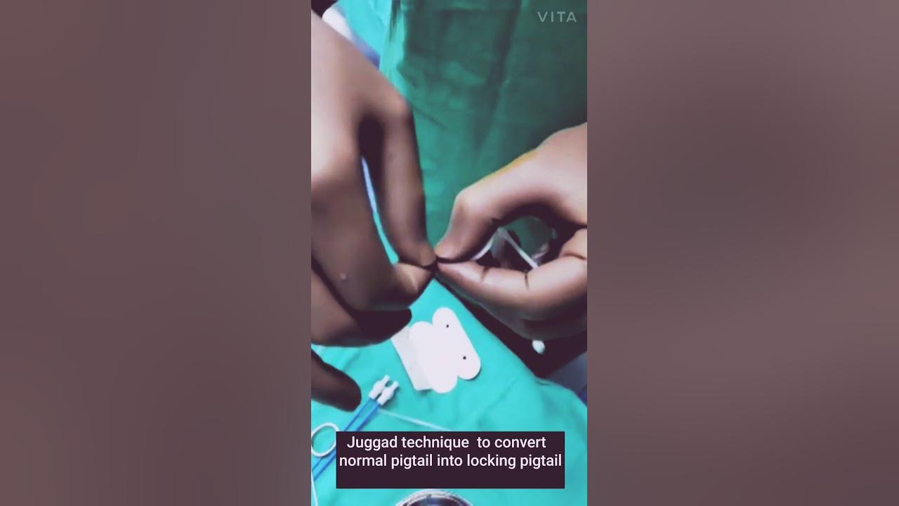 Converting simple pigtail into Locking pigtail catheter IR education catheters radiology