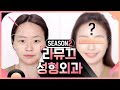 ENG [라뮤끄 성형외과] 무쌍눈 분위기 성형 메이크업✨(ft.비대칭 해결) | LAMUQE