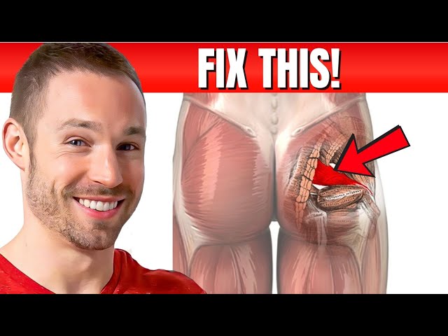 How to Correctly Treat Piriformis Syndrome – Squat University