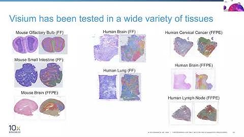 10x Genomics Spatial Analysis Solutions