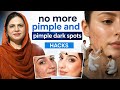 Naima Apa’s Good Gut Secret ✨ | No More Pimples &amp; Dark Spots | Skin Whitening Brightening Mask