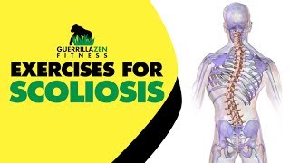 Exercises For Scoliosis | Unilateral Back Training