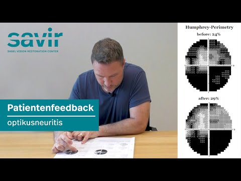 Video: Hoe optische neuritis te genezen (met afbeeldingen)