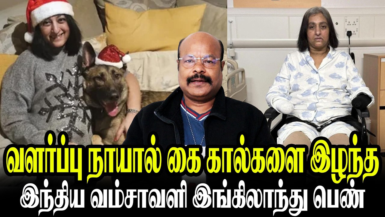 Dog Lick warning! நாய் நக்கினதுக்கு 2கை,கால்கள் அகற்றம் 😱 Sepsis Story| Jackiesekar  Kadhaippomvaa