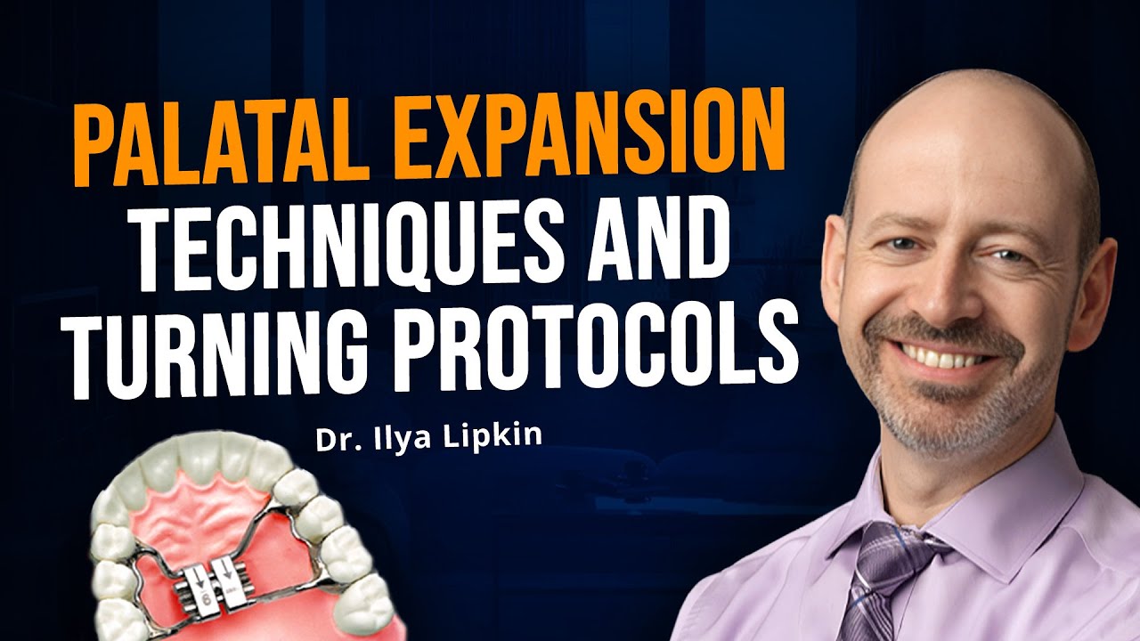 A New Less Aggressive Approach Towards Palatal Expansion in Adults w/ Dr. Ilya Lipkin