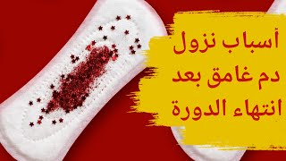 نزول دم غامق بعد انتهاء الدوره | أسباب نزول دم أسود بعد الدورة