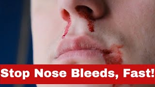 Stop The Flow: How to Stop Nose Bleeding Fast