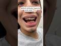 Would you try the miswak? . #cavities #toothbrush #teethwhitening