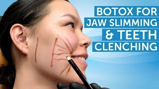 Botox for Jaw Slimming and Teeth Clenching | AAFE