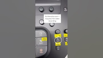 Philips ultrasound machine - how to record your echo findings