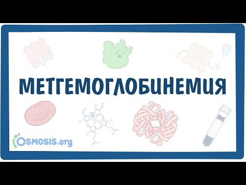 Метгемоглобинемия — причины, симптомы, патогенез, диагностика, лечение