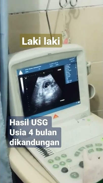 hasil USG 4 bulan