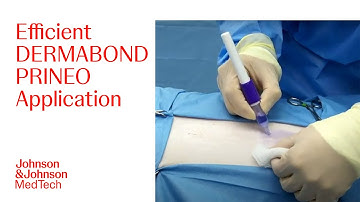 Step-by-Step Instructions for Applying the DERMABOND PRINEO 22cm | J&J MedTech