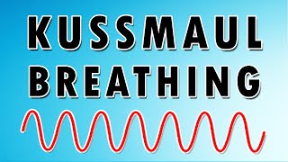 Kussmaul's Breathing Pattern (Causes, Sound, and Treatment)