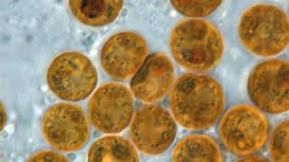 Symbiodinium | Wikipedia audio article