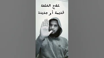 علاج الخلعة قديمة أو جديدة 