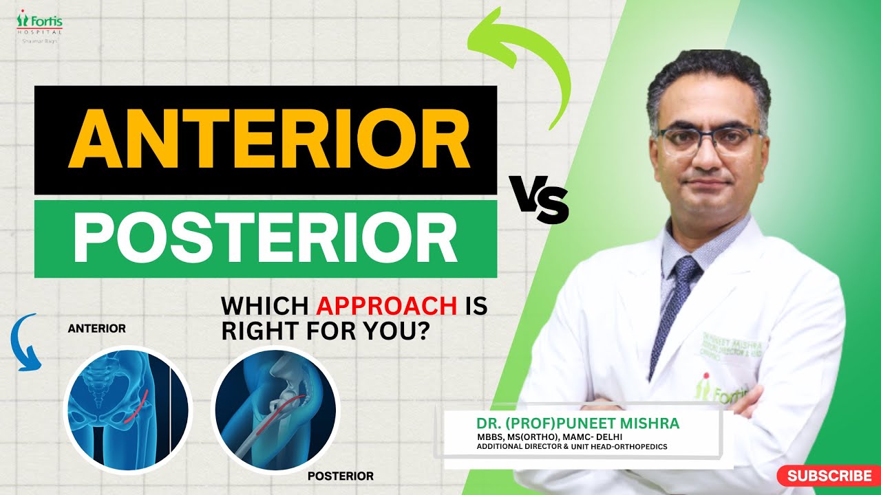 Anterior vs Posterior Hip Replacement: Which approach is right for you ...