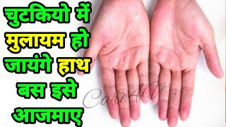 Get Soft Beautiful Hands in Winter / Homemade Moisturizer / Get Rid of Dry Hands - Care4U screenshot 1